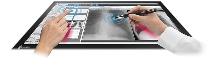 Amazon.co.jp: EIZO 10点マルチタッチ対応 23型電子カルテ画像表示