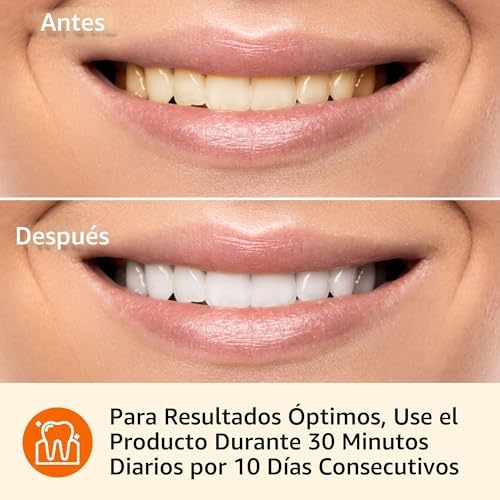 Amazon Basics 10 Day Teeth Whitening Strips Kit — side view showing full product dimensions