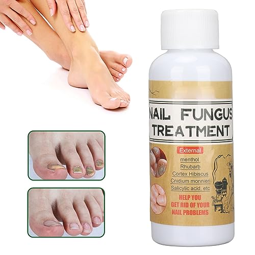 Soluzione di Riparazione delle Unghie 50 Ml