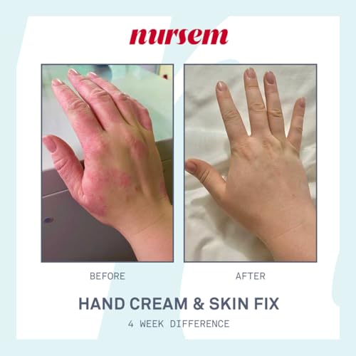 Nursem Caring Hand Cream – 300ml | Fast-Absorbing Natural Hand Cream for Very Dry Skin | Fragranced Moisturizer for Deep Hydration, Skin Repair & Protection for Dry, Cracked Hands - Image 5