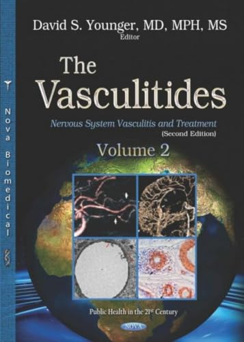 The Vasculitides: Nervous System Vasculitis and Treatment