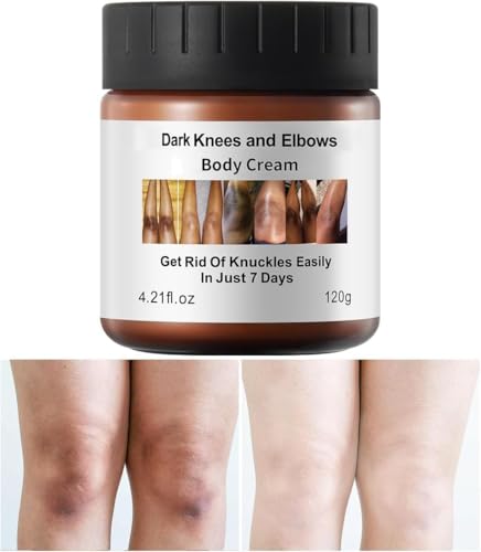 Dark Elbow and Knees Remover, Skin Brightening Cream for Dark Inner Thigh, Underarms, Armpit, Neck,