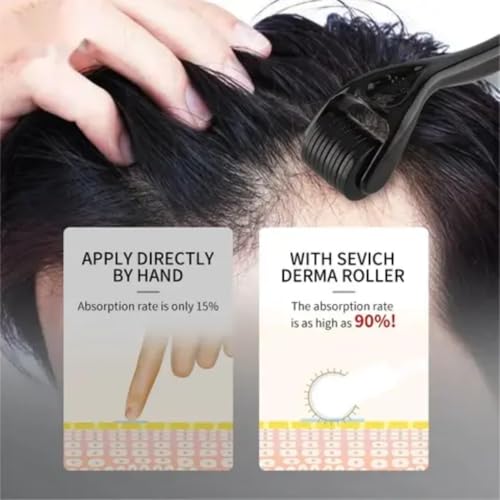 Image of Derma Roller 0.5mm With 540 Titanium Needles | Suitable for Anti-aging | Open Pores | Acne Scars | Hair & Beard Growth | Skin Care | Women and Men