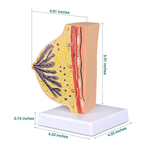 Image of Ultrassist Non-Lactating Breast Model, Human Anatomy Model, Breast Anatomical Model with Study Card for Doctor Surgeon Gift