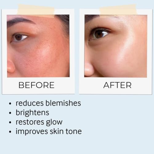 Image of Moroccan Nila Powder For Face - 100% Natural Blue Powder for Skin Brightening, Tan Removal & Detox | Traditional Moroccan Hammam Beauty Treatment For Face & Body Care - 50g