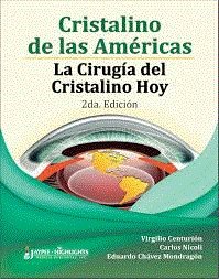 CRISTALINO DE LAS AMERICAS LA CIREGIA DEL CRISTALINO HOY