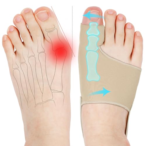 Corrector de juanetes para mujeres y hombres, calcetines de juanetes, correctores de dedos cómodos y transpirables para apoyo de día/noche, alivio del dolor Hallux Valgus, alisador antideslizante de