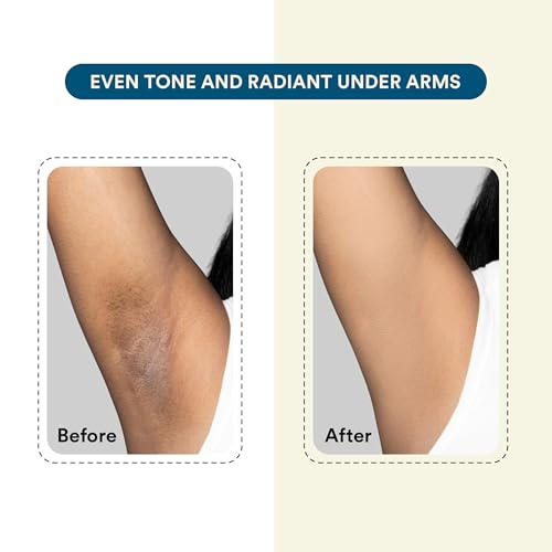 Image of Bloom by Bold Care Brightening Underarm Roll - With AHA, Melazaro & Kojic Acid | Dark Underarms, Pigmentation & Odour| Rapid Melanin Reduction Formula | 0 White Cast | 50ml