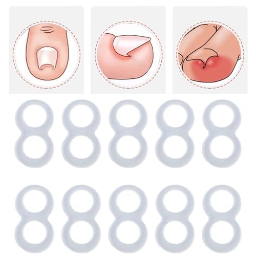 Corretor de unhas dos pés, 10 peças, ferramenta de correção de unhas encravadas de silicone reutiliz