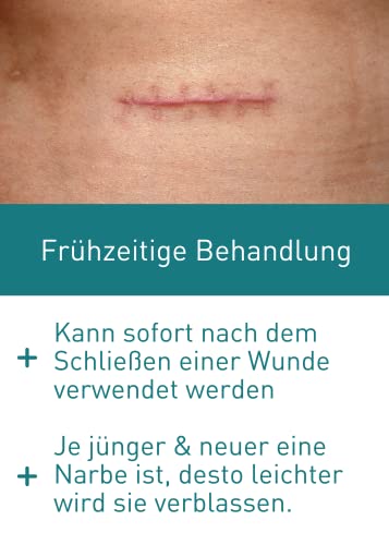 Narbenpflege N1 Narbengel 19 g für Kinder und Erwachsene