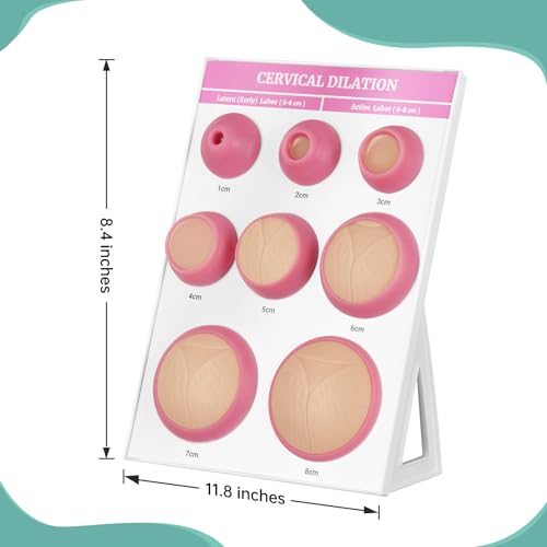 Image of Cervical Dilation Simulator with 1-8cm, Gynecological Examination Model, Chart on Display Board for Midwife and Doula Training, Medical Education, and Birth Learning