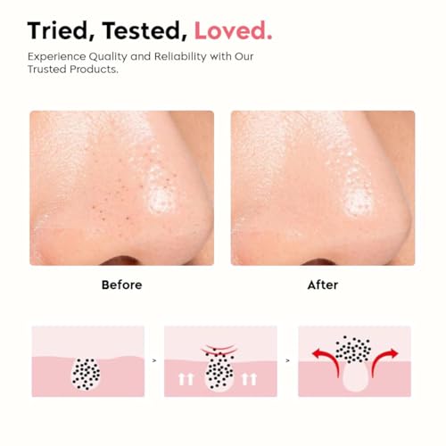 Image of Ice Roller for Face & Eyes | Silicone Ice Facial Massager for Skin Care, Puffiness, Dark Circles & Glowing Skin | Reusable Beauty Tool for Women & Men | Multi Color Variants (pink + BLUE)