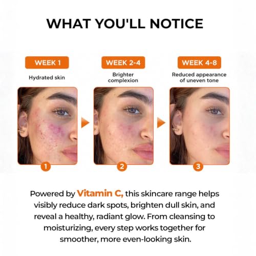 Image of Aqueria 10% Vitamin C Brightening Face Serum for Glowing Skin | 50ml | French Formulated Serum with 3% Niacinamide, Hyaluronic Acid & Vitamin E | For Dark Spots, Dull Skin & Uneveven Skin Tone