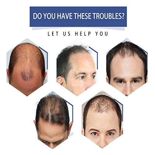 10 Wigs Wig Peruca Natural Sintética Da Parte Lateral Das Perucas Masculinas Retas Curtas Com Franja