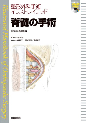 脊髄の手術 Dvd付 整形外科手術イラストレイテッド 馬場久敏 戸山芳昭 本 通販 Amazon