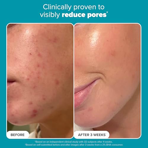 Paula's Choice SKIN PERFECTING 2% BHA Liquid Salicylic Acid Exfoliant, Daily Facial Exfoliator for Enlarged Pores, Wrinkles & Fine Lines, Fragrance-Free, Full Size - 118 ml - Image 6