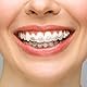 BVN Zahnspangen Wachs KieferorthopäDisches Zahnwachs: 10 StüCk/50 Streifen Zahnwachs füR Zahnspange, Zahnspangenwachs, Dentalwachs füR ZahnspangenträGer zur Linderung Von Reizungen Und Schmerzen