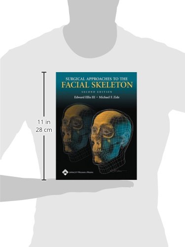 Surgical Approaches To The Facial Skeleton