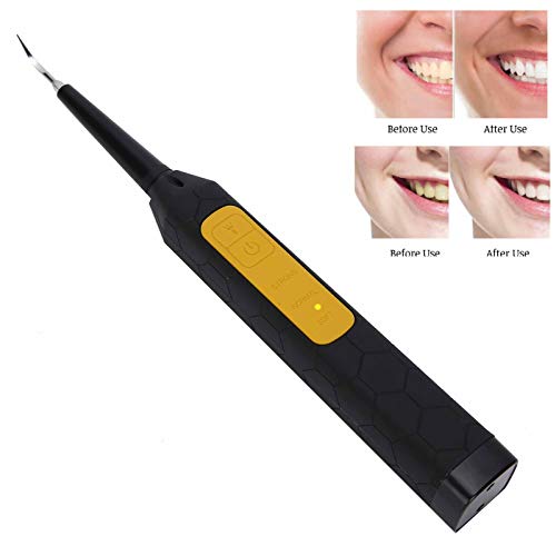 Limpador de dentes, limpador de dentes USB profissional, removedor de cálculos elétrico, removedor p