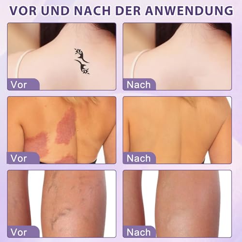 70g Body Coverage Perfector, 2 Stück Körper Make Up Wasserfest, Concealer, Narben Abdecken Abdeckung, Krampfadern Abdecken, Bein Make Up Wasserfest ohne Übertragung, Abdecken Wasserfest Foundation