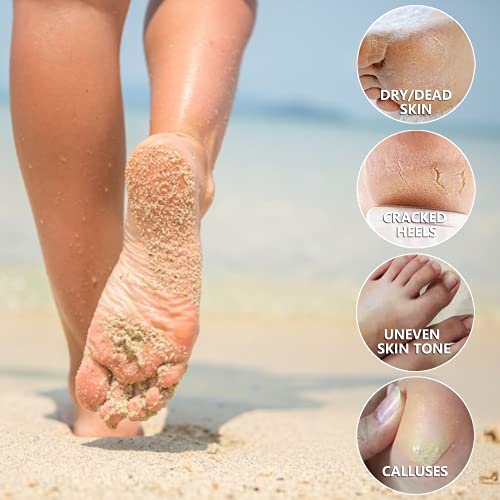 Cmwgkbc 5 Pack Foot Peel Mask,Exfoliator Peel Off Calluses Dead Skin Callus Remover,Foot Mask For Dry Cracked Feet,Foot Peel Mask With Lavender And Aloe Vera Gel For Men And Women Feet Peeling Mask thumb #4