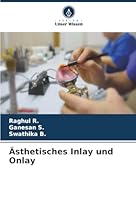Ästhetisches Inlay und Onlay (German Edition) 6202419814 Book Cover