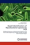 Rapid Identification of Mycobacterial species by PCR: PCR Based Diagnosis of Mycobacterial species using RFLP & DNA sequencing of Hyper variable 16S rRNA Gene Promoter Region