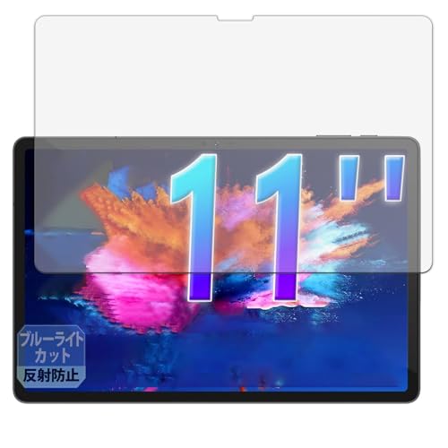 Leipsden AvidPad S80 �Ή� Blue Shield �ی� �t�B���� �u���[���C�g�J�b�g �ڂɗD���� ���˒ጸ ���{��