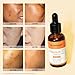 NEUTRIHERBS Vitamin C Serum for Face with Hyaluronic Acid, Firm, Anti Aging, Brighten, Even Skin, Daily Skincare Natural Nourish Facial Serum,1 fl oz