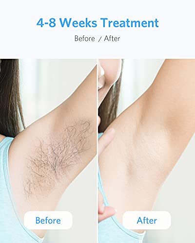 FIDAC IPL Hair Removal for Women & Men, Laser Hair Removal Device with FDA Certification, Permanent Hair Removal with 999,999 Flashes, Professional Hair Remover Device for Facial Whole Body at-Home - Thumbnail 7