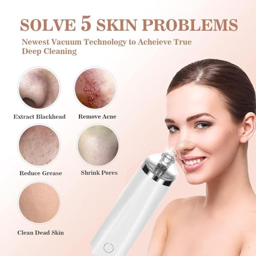 Luxury Confidence Keratin Remover Blackhead Remover Pore Vacuum Electric Face Vacuum Pore Cleaner White Heads Removal with 3 Modes and 4 Suction Heads Nose Hair Removal (Pink+White, One Size) - Image 6