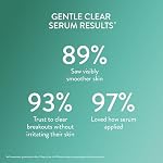 Cetaphil Gentle Salicylic Acid Acne Serum, Pore Minimizer Serum for Sensitive Acne-Prone Skin, Niacinamide & Zinc Acne Treatment, Hypoallergenic, Dermatologist Recommended