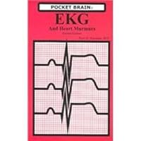 Ekg and Heart Murmurs (Pocket Brain) 1932412026 Book Cover