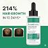 Rosemary Advanced Hair Growth Serum | 3% Redensyl, 4% Anagain, 3% Baicapil, 1% Capilia Longa, Rosemary, Biotin & Rice Water | Controls Hair Fall & Supports Hair Density | for Women & Men | 50ml