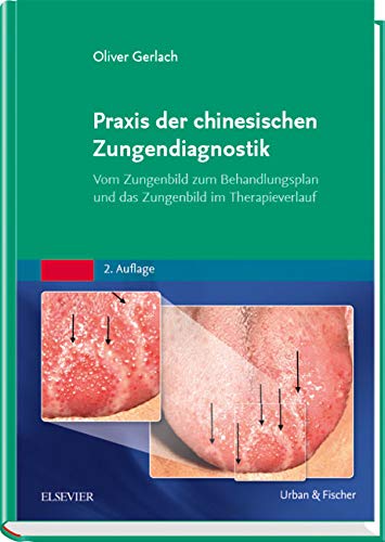 Praxis der chinesischen Zungendiagnostik: Vom Zungenbild zum Behandlungsplan und das Zungenbild im T