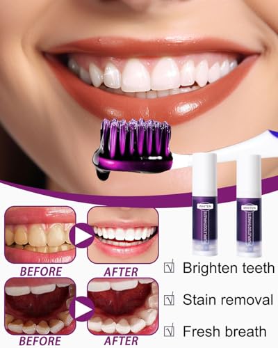 CHBCD 2PCS Original- Purple Teeth Whitening Toothpaste, Whitening Zahnpasta, Zahnfleckenentfernung, Lila Zahnpasta für Zahnaufhellung,Eine Schonende Pflege Des Zahnfleisches