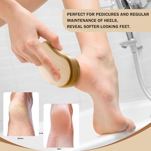 FVION Nano Glass Foot File for Callus Remover, Foot Scraper Dead Skin for Foot Spa - Image 2