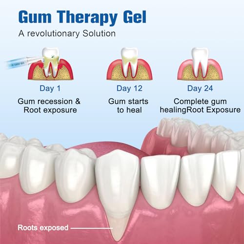 Image of Taileden Gum Therapy Gel, Taileden Gum Care Gel, Taileden Gum Therapy Gel for Recessed Gums, Gum Shield Therapy Gel, Teeth Whitening Essence Pen (3PCS)