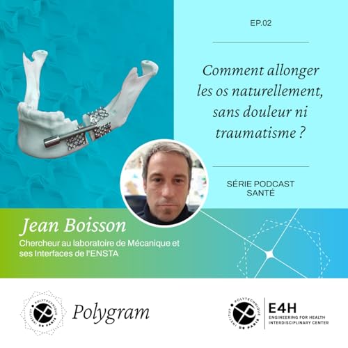Comment allonger les os naturellement, sans douleur ni traumatisme ? cover art