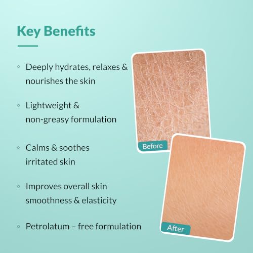 Image of Fixderma Dewrav 10% Magnesium Oil Moisturizing Cream for Face & Body with Shea Butter | Deep Moisturizer for Dry to Very Dry Skin | Soothes Irritation & Supports Skin Barrier Repair- 500g