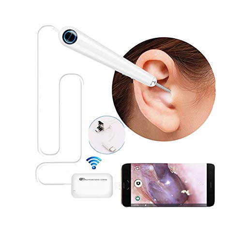 WiFi-Ohrendoskop, Otoskop, tragbare Inspektionskamera, 720P HD, wasserdicht, inklusive Ohrenschmalz-Reinigungswerkzeug für iOS, Android, Windows,