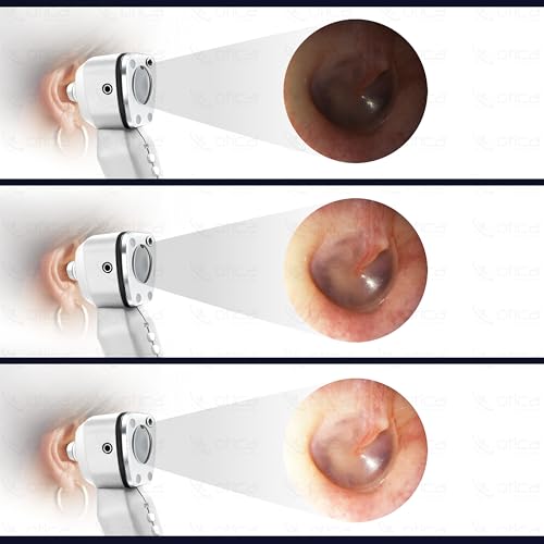 Image of OTICA 3.7V Professional Diagnostic Pocket LED Otoscope | Rechargeable In-Built 3500mAh Battery | Type-C Charging | Adjustable Intensity | 10 Disposable Specula + Spare Glass | 11707 - White