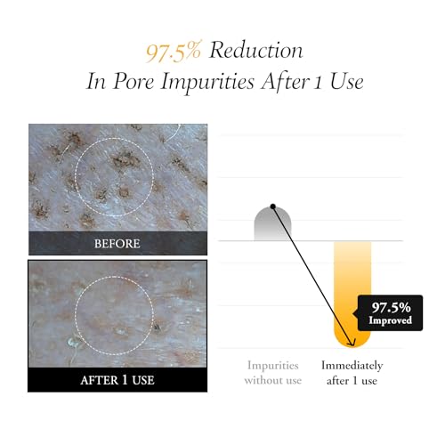Aprilskin Calendula Peel Off Pore Minimizing Facial Mask | Vegan | Blackhead Remover, Exfoliating, Deep Cleansing | PHA BHA | Korean Skin Care | K Beauty | 3.52 oz - Thumbnail 5