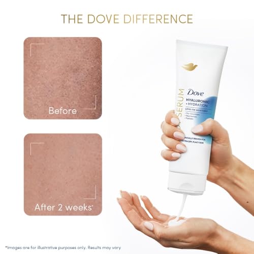 Image of Dove Hyaluronic + Hydration Body Serum | Clinically Proven Hydrating Body Lotion for Extra Dry, Flaky Skin | 72H Moisture | With Hyaluronic Acid, Pro-Ceramides & Niacinamide | 240ml