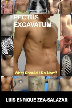 Paperback PECTUS EXCAVATUM: What Should I Do Now? Book
