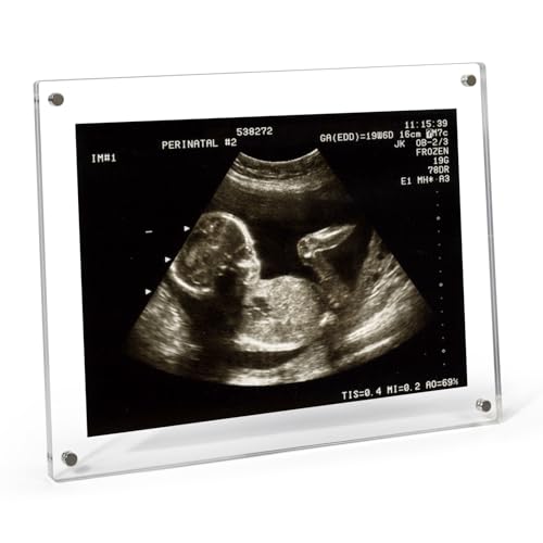 Gocjumfe 6x8 Ultrasound Picture Frame (Rectangle - No Stand)