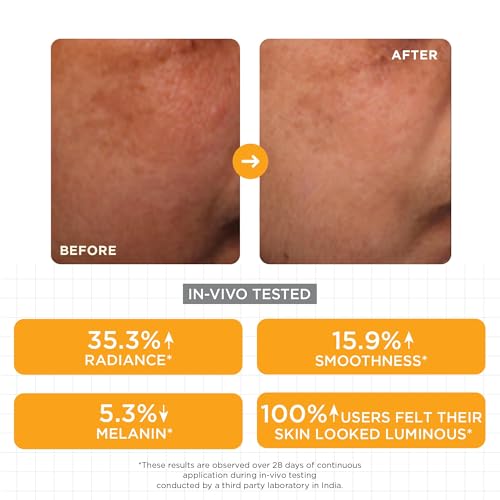 Image of SKINQ Brightening Face Serum with Kojic Acid, Lactic Acid & Malic Acid | Skin Radiance | Reduces Tan, Pigmentation & Dark Spots | Lightweight Glow Serum | For All Skin Types | In-Vivo Tested | Dermatologist Formulated (Pack of 2)