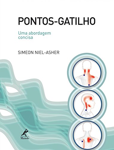 Pontos-gatilho: Uma abordagem concisa