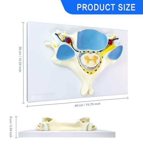 Image of EVOTECH SCIENTIFIC Enlarged Human Fifth Section Cervical Vertebra Anatomical Model with Spinal Cord, 7X Enlarged Transection Cervical Vertebra Model for Medical Learning Research Education Display
