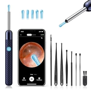 Ear Wax Removal – Earwax Remover Tool with 8 Pcs Ear Set – Ear Canal Cleaner with 1080P Camera – FSA HSA Eligible – Ear Cleaning Kit with 6 Ear Spoon – Ear Camera for iOS & Android (Midnight Blue)